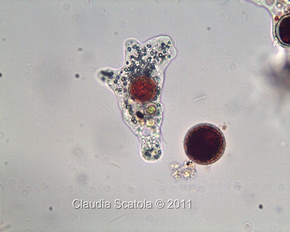 Ameba ed ematococco (Haematococcus pluvialis)